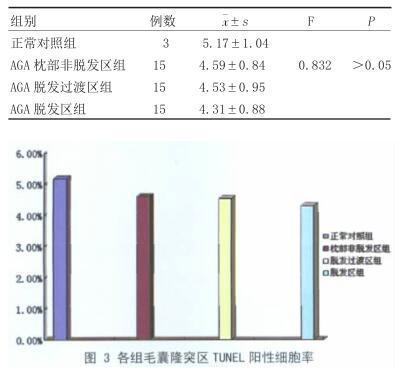 脱发研究最新进展，探索新治疗策略与解决方案